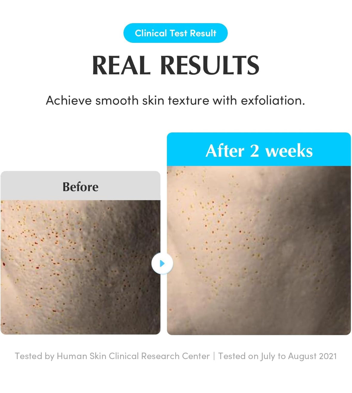 Swimming Pool Toner - Korean Toner for Daily Exfoliating & Deep Hydration with Natural Enzyme Protease & Hyaluronic Acid, For Sensitive Skin, 10.14 Fl Oz (300ml)