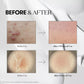 VT Cosmetics Reedle Shot 100
