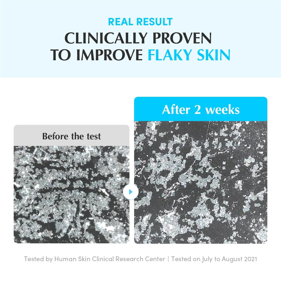 Swimming Pool Toner - Korean Toner for Daily Exfoliating & Deep Hydration with Natural Enzyme Protease & Hyaluronic Acid, For Sensitive Skin, 10.14 Fl Oz (300ml)